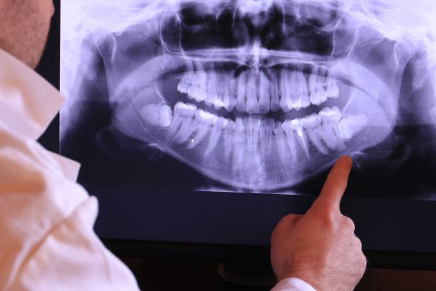 Best Emergency Gum Treatment in Rose Lodge, OR