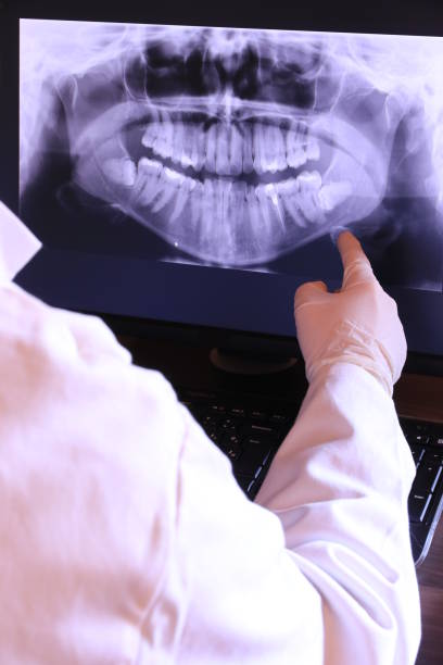 Best Urgent Care for Lost Fillings or Crowns in Rose Lodge, OR